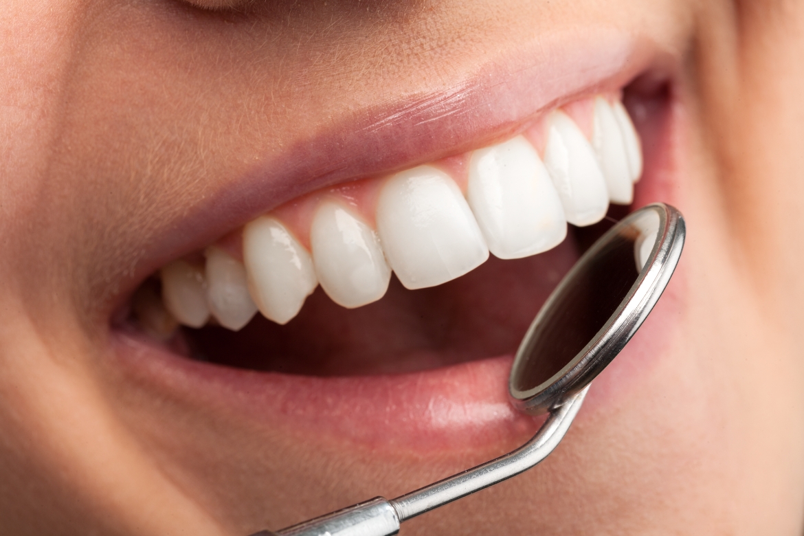 Trattamenti dentali, Cure odontoiatriche Roma