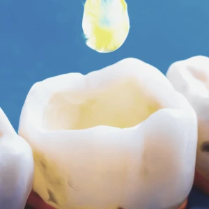 ricostruzione-endodonzia.mto