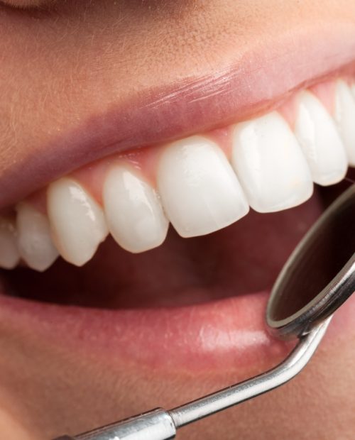 diagnosi dentista